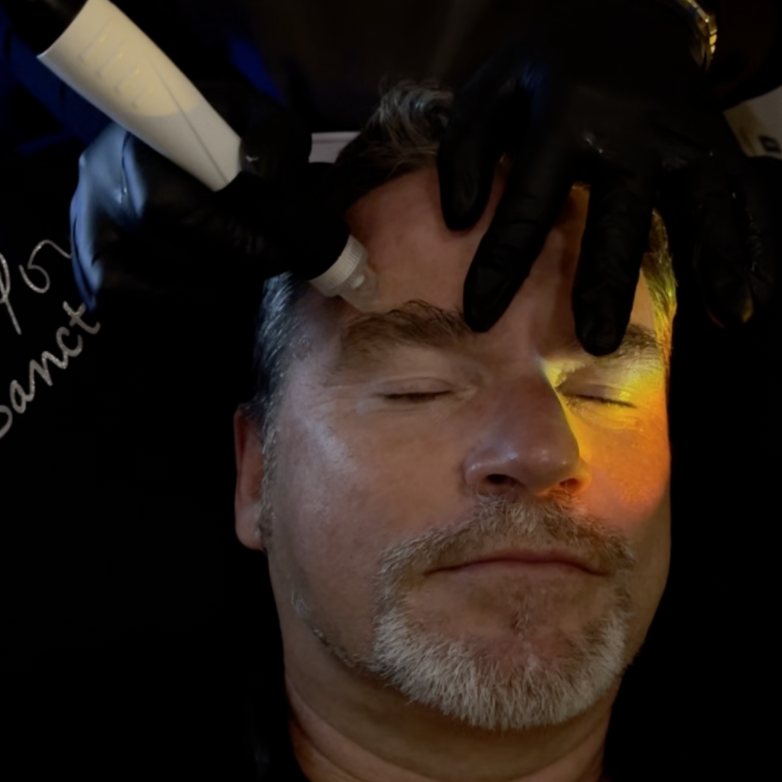 Man having pore extraction