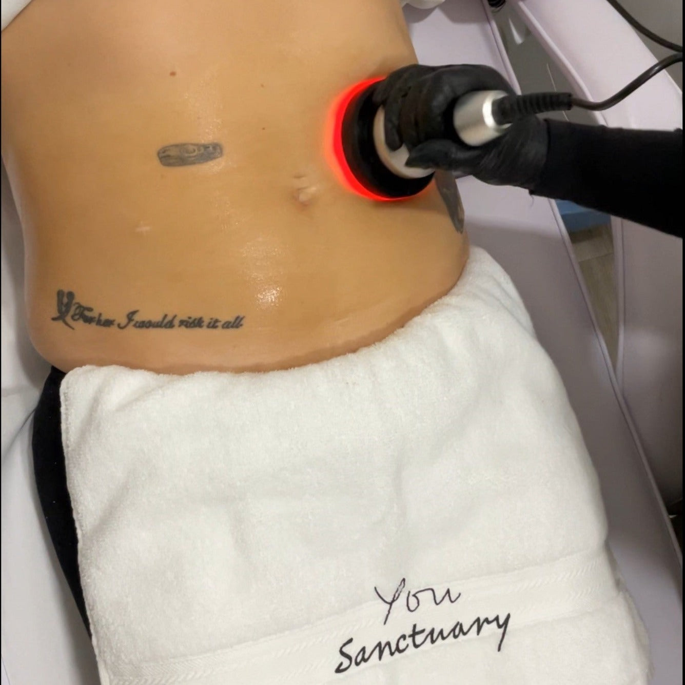 Woman getting cavitation