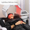 LightWave Wellness: Acne